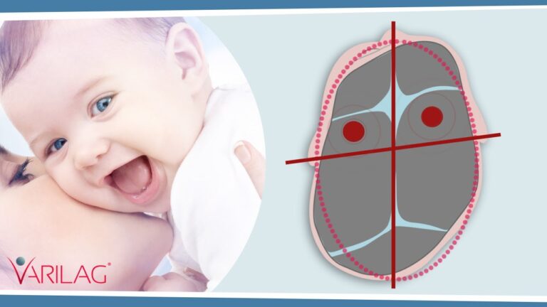 Le sorprendenti conseguenze del trauma da parto: scopri come influisce sulla vita delle mamme
