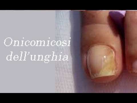 Il pedicure curativo con il podologo a Bologna: scopri come prenderti cura dei tuoi piedi